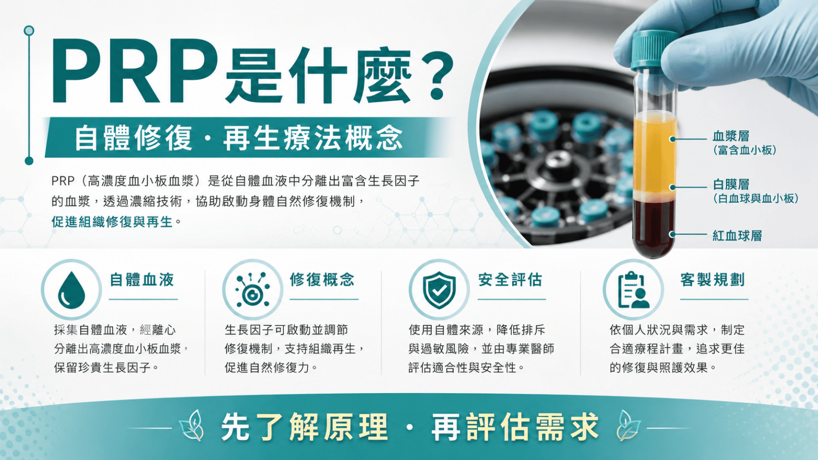 PRP治療 是 Platelet-Rich Plasma 的縮寫,中文常稱為血小板濃縮治療。